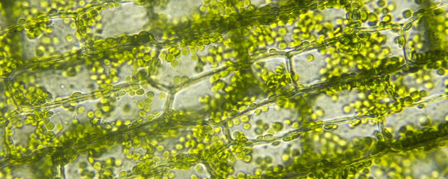 Хлорофиллы цианобактерий. Хлоропласт микрофотография. Элодея фотосинтез. Хлорофилл в клетках растения. Элодея канадская.